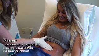 Coolsculpting Overview