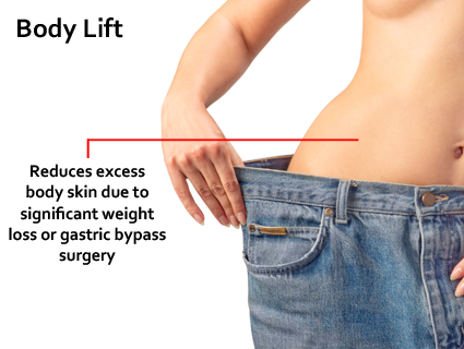 The body lift can be one of the more extensive plastic surgery procedures and probably requires more recovery time.