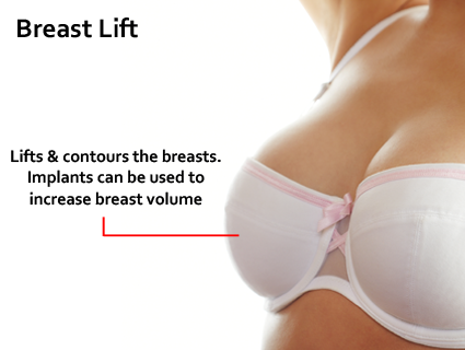 The design of the incisions can vary, but usually include incisions around the nipple-areolar complex and in the crease under the breast. Breast Lift in Lexington, KY