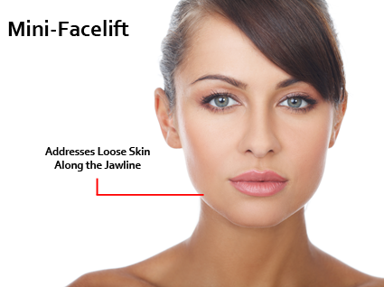 Dr. Waldman believes that facelifts should be individualized accommodating to each patient's personal needs. Dr. Waldman | Lexington, KY