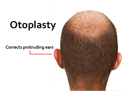 The ears are usually bandaged with a dressing that wraps around the head in a turban-like fashion for several days. Dr. Waldman | Lexington, KY