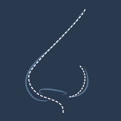 A drooping nasal tip